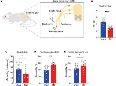 Environmental enrichment promotes resilience to neuropathic pain-induced depression and correlates with decreased excitability of the anterior cingulate cortex